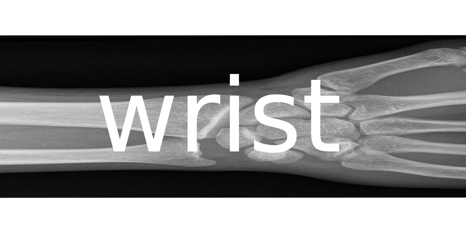 look at wrist w... | Register