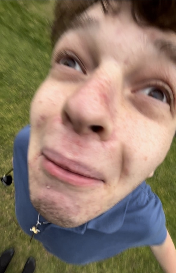 Dboom