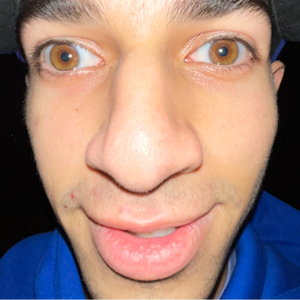 Shmunky