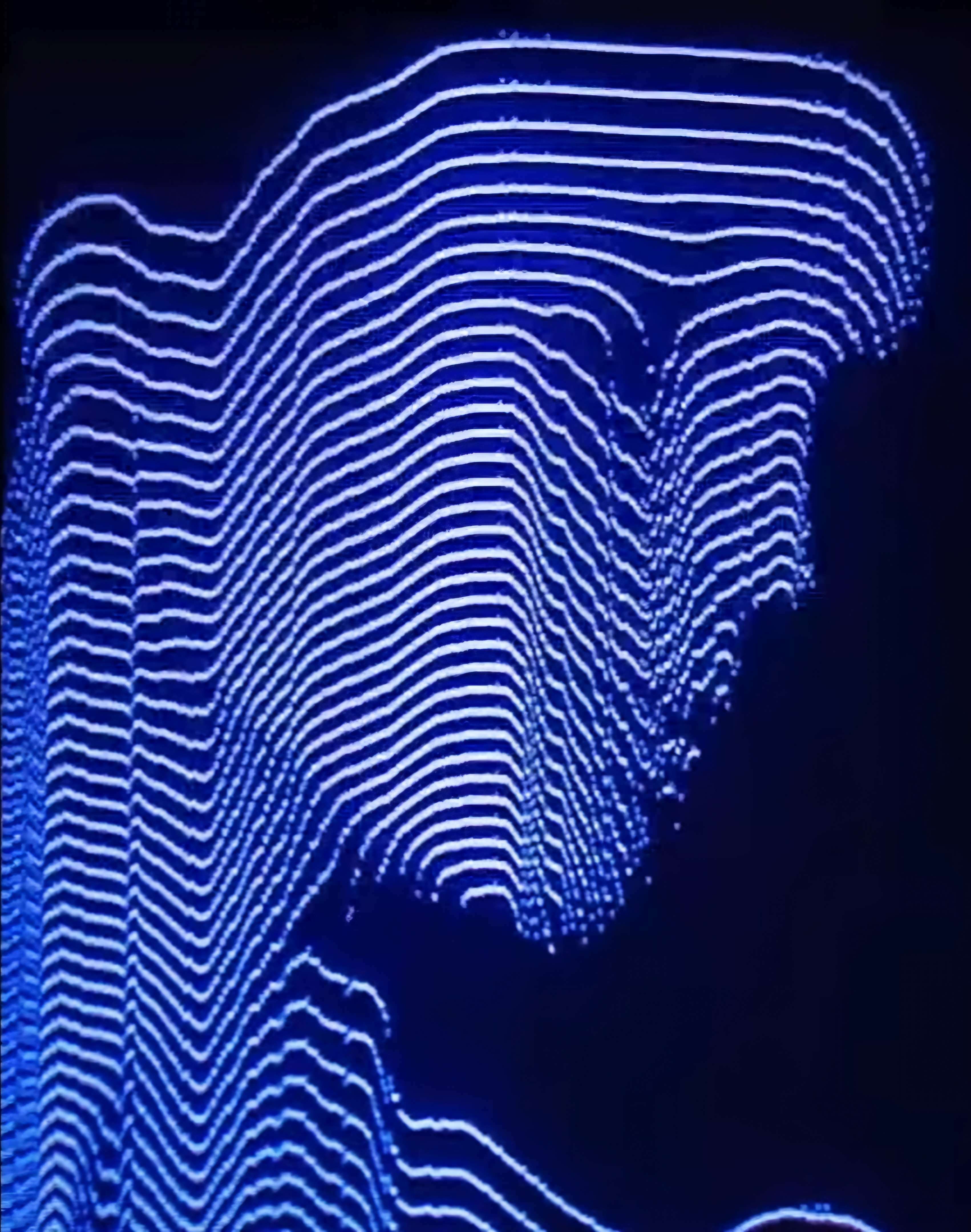 dopamine